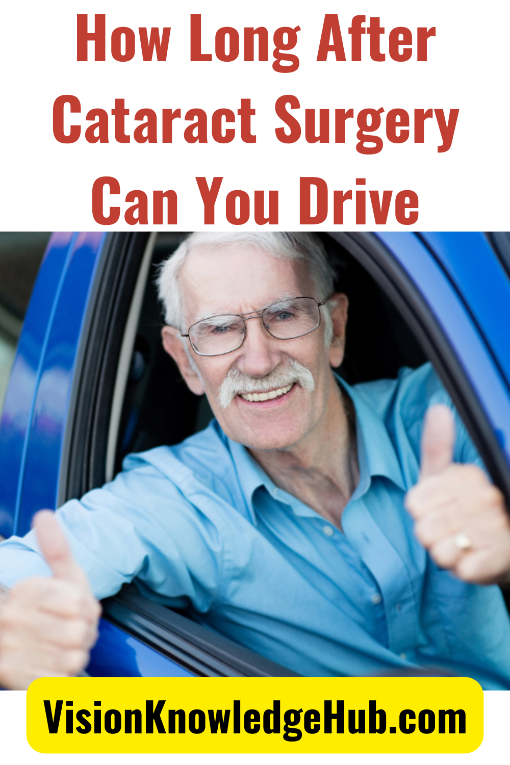 how-long-after-cataract-surgery-can-you-drive